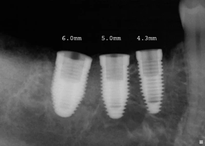 Tri-Nex IA-L-43